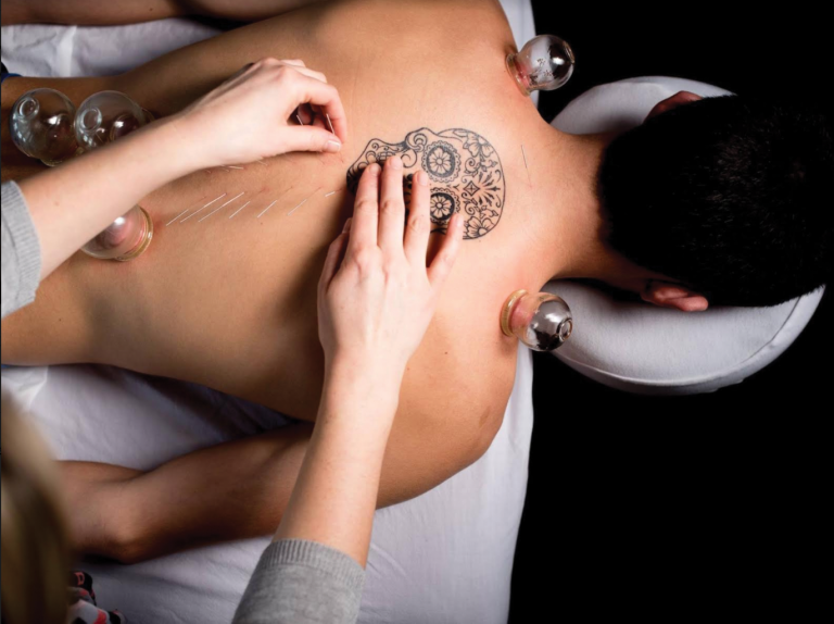 Return to health naturally with acupuncture