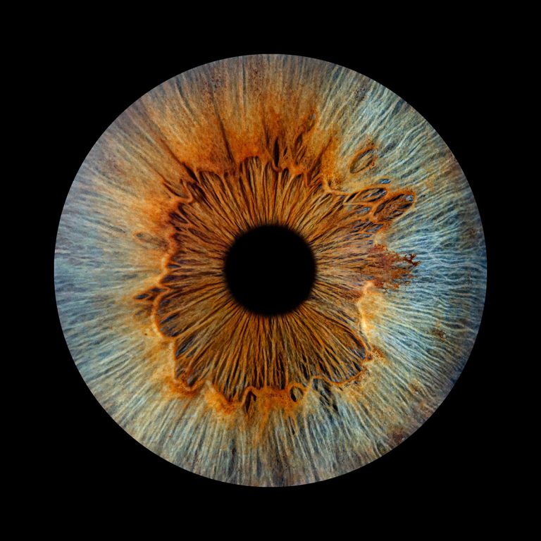 The eyes have it.
